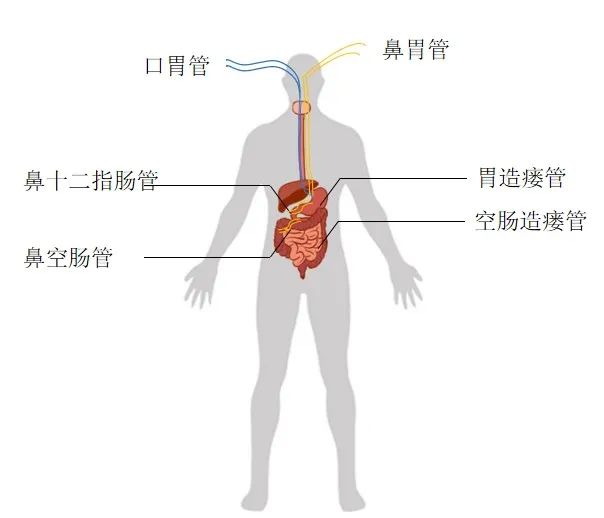 肠道位置图片 结构图图片